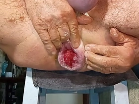 Gapingman 2025-14 copulation gay asian videos