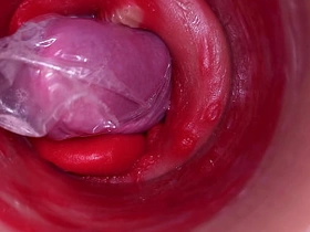 The camera inside the deep pussy records a popular ejaculation encircling a stuck condom asian gay irritant coition videos