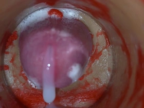 Insemination - Internal Camera Captures Deep Male Ejaculation free online asian merry sex videos