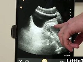 I wanted to watch my detect breed him with the ultrasound though - Littletwink asian dad gay sex videos
