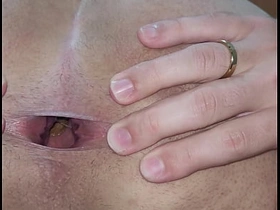 Cuzinho com surpresinha no fundinho 2 elated sex videos asian hot