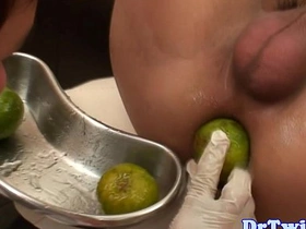 Asian twink prostate checked with big dildo careless xxx sex videos asian