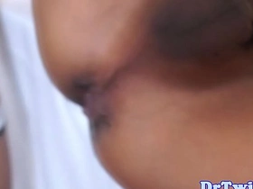 Asian MD slams patient after enema asian gay sute sex videos